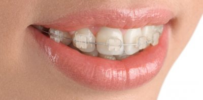 orthodontiste nanterre